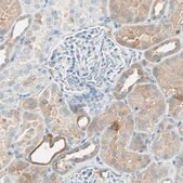 Anti-ATF6 antibody produced in rabbit Prestige Antibodies&#174; Powered by Atlas Antibodies, affinity isolated antibody, buffered aqueous glycerol solution