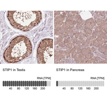 Anti-STIP1 antibody produced in rabbit Prestige Antibodies&#174; Powered by Atlas Antibodies, affinity isolated antibody, buffered aqueous glycerol solution