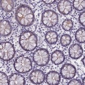 Anti-TACSTD2 antibody produced in rabbit Prestige Antibodies&#174; Powered by Atlas Antibodies, affinity isolated antibody, buffered aqueous glycerol solution