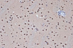 [KO Validated]Anti-HDAC8 Antibody, clone 1O2Y5, Rabbit Monoclonal