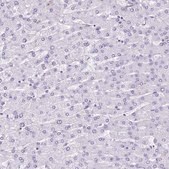 Anti-PROCR antibody produced in rabbit Prestige Antibodies&#174; Powered by Atlas Antibodies, affinity isolated antibody, buffered aqueous glycerol solution