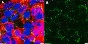 Anti-Prohibitin 1 Antibody, clone 1N19 ZooMAb® Rabbit Monoclonal recombinant, expressed in HEK 293 cells