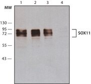 Anti-SOX11 antibody produced in rabbit ~1.0 mg/mL, affinity isolated antibody