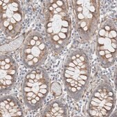 Anti-CAAP1 antibody produced in rabbit Prestige Antibodies&#174; Powered by Atlas Antibodies, affinity isolated antibody, buffered aqueous glycerol solution, Ab3