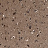 Anti-YARS antibody produced in rabbit Prestige Antibodies&#174; Powered by Atlas Antibodies, affinity isolated antibody, buffered aqueous glycerol solution