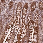 Anti-PEX14 antibody produced in rabbit Prestige Antibodies&#174; Powered by Atlas Antibodies, affinity isolated antibody, buffered aqueous glycerol solution