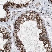 Anti-CDR2 antibody produced in rabbit Prestige Antibodies&#174; Powered by Atlas Antibodies, affinity isolated antibody, buffered aqueous glycerol solution