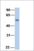 Anti-LCAT (AB1) antibody produced in rabbit affinity isolated antibody