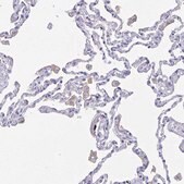 Anti-FCGR3A antibody produced in rabbit Prestige Antibodies&#174; Powered by Atlas Antibodies, affinity isolated antibody, buffered aqueous glycerol solution