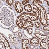Anti-LRRIQ1 antibody produced in rabbit Prestige Antibodies&#174; Powered by Atlas Antibodies, affinity isolated antibody, buffered aqueous glycerol solution