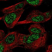 Anti-CASC10 antibody produced in rabbit Prestige Antibodies® Powered by Atlas Antibodies, affinity isolated antibody, buffered aqueous glycerol solution