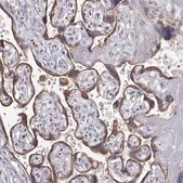 Anti-STARD13 antibody produced in rabbit Prestige Antibodies&#174; Powered by Atlas Antibodies, affinity isolated antibody, buffered aqueous glycerol solution