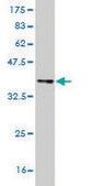 ANTI-IKBKB antibody produced in mouse clone 3C12, purified immunoglobulin, buffered aqueous solution