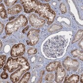 Anti-GDPD3 antibody produced in rabbit Prestige Antibodies&#174; Powered by Atlas Antibodies, affinity isolated antibody, buffered aqueous glycerol solution
