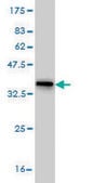 Monoclonal Anti-HDAC5 antibody produced in mouse clone 4G2, purified immunoglobulin, buffered aqueous solution