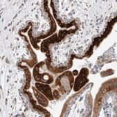 Anti-KIAA1456 antibody produced in rabbit Prestige Antibodies® Powered by Atlas Antibodies, affinity isolated antibody, buffered aqueous glycerol solution, Ab3