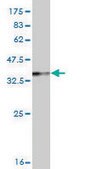 Monoclonal Anti-RTKN antibody produced in mouse clone 2E5, purified immunoglobulin, buffered aqueous solution