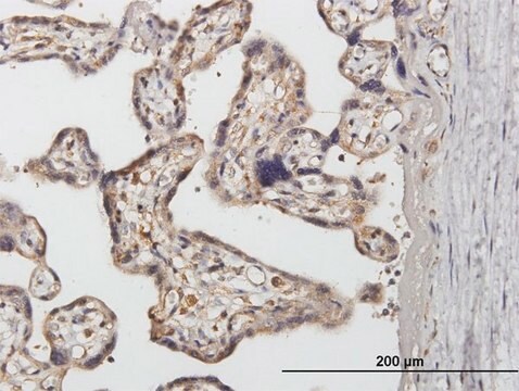 Anti-SNX1 antibody produced in mouse purified immunoglobulin, buffered aqueous solution