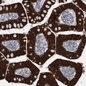 Anti-KRT20 antibody produced in rabbit Prestige Antibodies&#174; Powered by Atlas Antibodies, affinity isolated antibody, buffered aqueous glycerol solution, Ab3