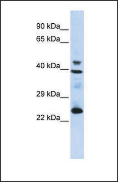 Anti-SEPP1, (N-terminal) antibody produced in rabbit affinity isolated antibody