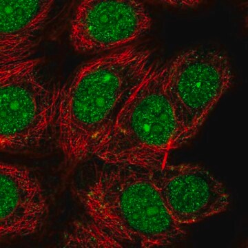 Anti-Dedd Antibody Produced In Rabbit Prestige Antibodies&#174; Powered by Atlas Antibodies, affinity isolated antibody, buffered aqueous glycerol solution