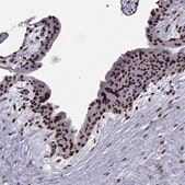 Anti-ARID3A antibody produced in rabbit Prestige Antibodies&#174; Powered by Atlas Antibodies, affinity isolated antibody, buffered aqueous glycerol solution