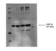Anti-HNF1A, (N-terminal) antibody produced in rabbit affinity isolated antibody