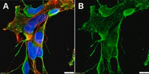 Anti-SCN10A Antibody, clone 1J13 ZooMAb® Rabbit Monoclonal recombinant, expressed in HEK 293 cells