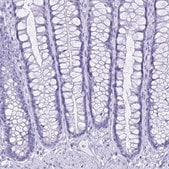 Anti-CGB3 antibody produced in rabbit Prestige Antibodies® Powered by Atlas Antibodies, affinity isolated antibody, buffered aqueous glycerol solution