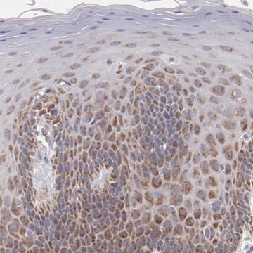 Anti-HCCS antibody produced in rabbit Prestige Antibodies&#174; Powered by Atlas Antibodies, affinity isolated antibody, buffered aqueous glycerol solution