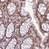 Anti-ABHD17A antibody produced in rabbit Prestige Antibodies® Powered by Atlas Antibodies, affinity isolated antibody, buffered aqueous glycerol solution