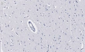 Anti-Histone H2A.X Antibody, clone 1C22 ZooMAb&#174; Rabbit Monoclonal recombinant, expressed in HEK 293 cells