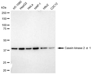 Anti Casein kinase 2 alpha 1 Antibody, clone 23GB1240, Rabbit Monoclonal clone 23GB1240, recombinant rabbit monoclonal, expressed in HEK293 cells