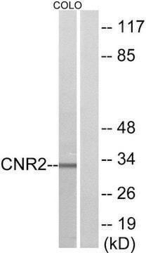 Anti-CNR2 antibody produced in rabbit affinity isolated antibody