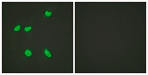 Anti-Histone H4 (Acetyl-Lys16) antibody produced in rabbit affinity isolated antibody
