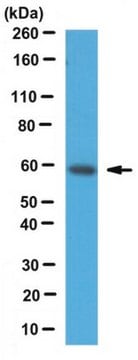 Anti-PKM2 Antibody serum, from rabbit