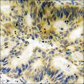 Anti-phospho-Stathmin 1 (pSer24) antibody produced in rabbit affinity isolated antibody