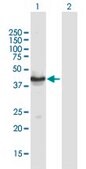 Anti-TUSC4 antibody produced in mouse IgG fraction of antiserum, buffered aqueous solution