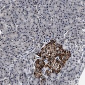Anti-USP16 antibody produced in rabbit Prestige Antibodies&#174; Powered by Atlas Antibodies, affinity isolated antibody, buffered aqueous glycerol solution