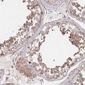 Anti-SAT1 antibody produced in rabbit Prestige Antibodies® Powered by Atlas Antibodies, affinity isolated antibody, buffered aqueous glycerol solution