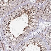 Anti-ATG3 antibody produced in rabbit Prestige Antibodies&#174; Powered by Atlas Antibodies, affinity isolated antibody, buffered aqueous glycerol solution