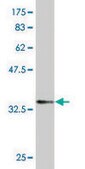 Monoclonal Anti-SPDEF antibody produced in mouse clone 4A5, purified immunoglobulin, buffered aqueous solution