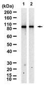 Anti-BTK Antibody, clone 1F5 ZooMAb® Rabbit Monoclonal recombinant, expressed in HEK 293 cells