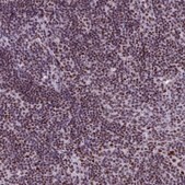 Anti-SRSF4 antibody produced in rabbit Prestige Antibodies&#174; Powered by Atlas Antibodies, affinity isolated antibody, buffered aqueous glycerol solution