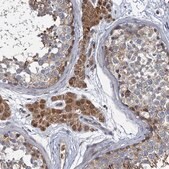 Anti-BCS1L antibody produced in rabbit Prestige Antibodies® Powered by Atlas Antibodies, affinity isolated antibody, buffered aqueous glycerol solution