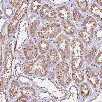 Anti-AP3M1 antibody produced in rabbit Prestige Antibodies&#174; Powered by Atlas Antibodies, affinity isolated antibody, buffered aqueous glycerol solution