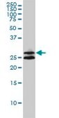 Monoclonal Anti-ASB9 antibody produced in mouse clone 1D8, purified immunoglobulin, buffered aqueous solution