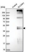 Anti-SLC29A1 antibody produced in rabbit Prestige Antibodies® Powered by Atlas Antibodies, affinity isolated antibody, buffered aqueous glycerol solution