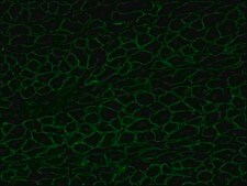Anti-Dystrophin antibody, Mouse monoclonal clone MANDYS8, purified from hybridoma cell culture