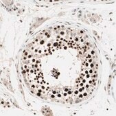 ANTI-MDC1 antibody produced in rabbit Prestige Antibodies&#174; Powered by Atlas Antibodies, affinity isolated antibody, buffered aqueous glycerol solution